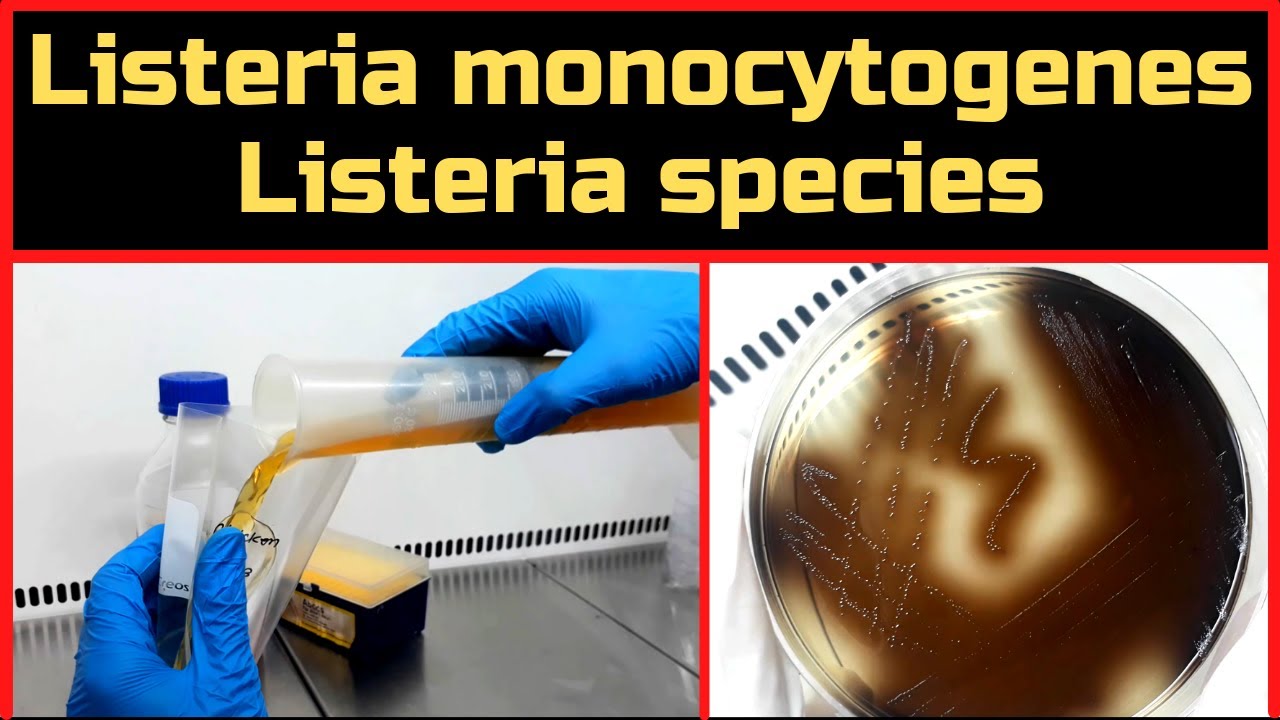 Обнаружение Listeria monocytogenes и видов Listeria_Полная процедура (ISO 11290-1 и BAM, Ch-10)