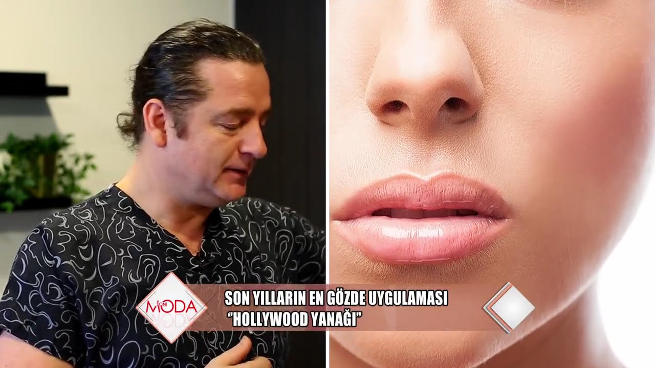 Hollywood yanağı nedir? Faydaları var mı? Zararları neler?