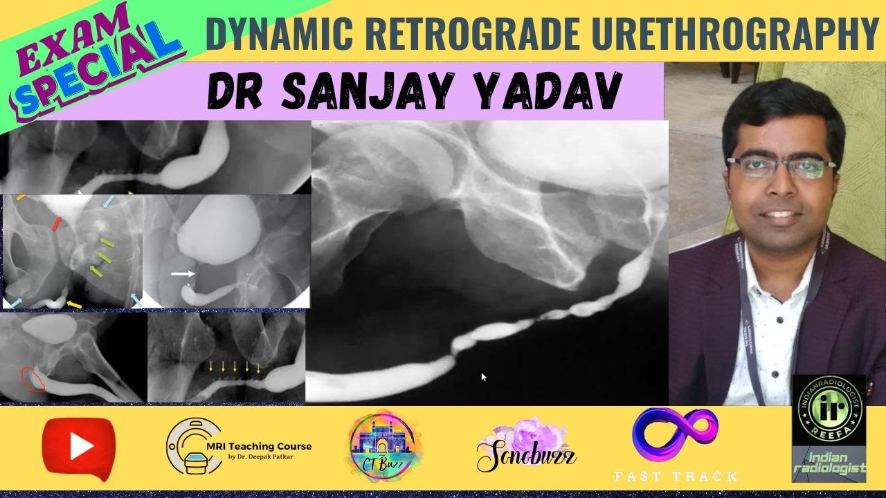 Dynamic Retrograde Urethrography | Dr Sanjay P | DRU #urethralstricture