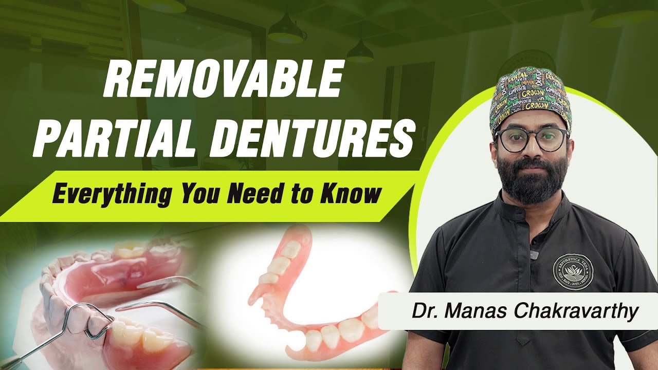 Complete Guide to Removable Partial Dentures. Uses & Types -Dr. Manas Chakravarthy | Aesthetica Veda