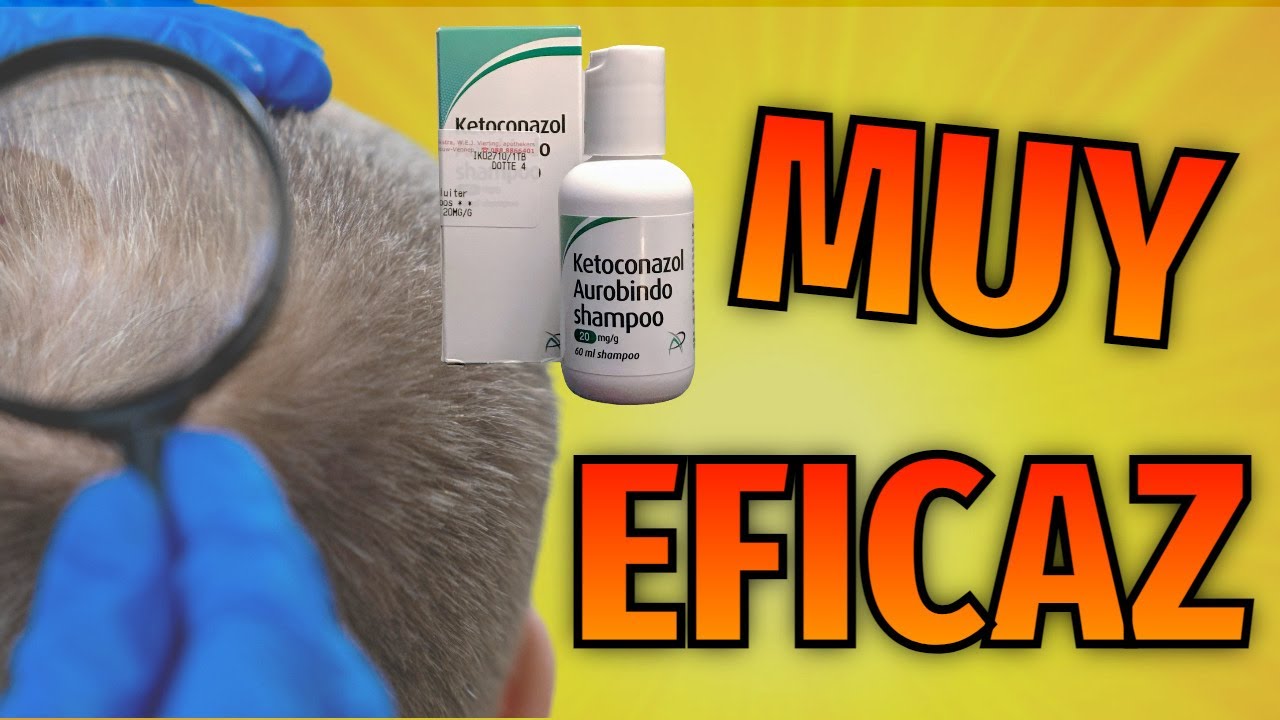 KETOCONAZOL Alopecia Androgenetica | ⚠ Qué es y para QUÉ SIRVE
