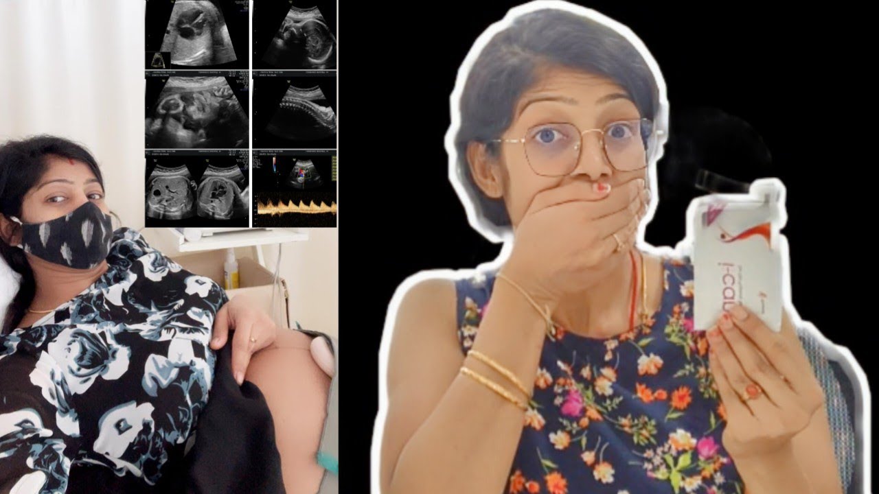 I am Pregnant | ನಾನು ಬಸುರಿ & ನನಗೆ ಗೊತ್ತೇ ಇಲ್ಲ |  My Pregnancy Story |
