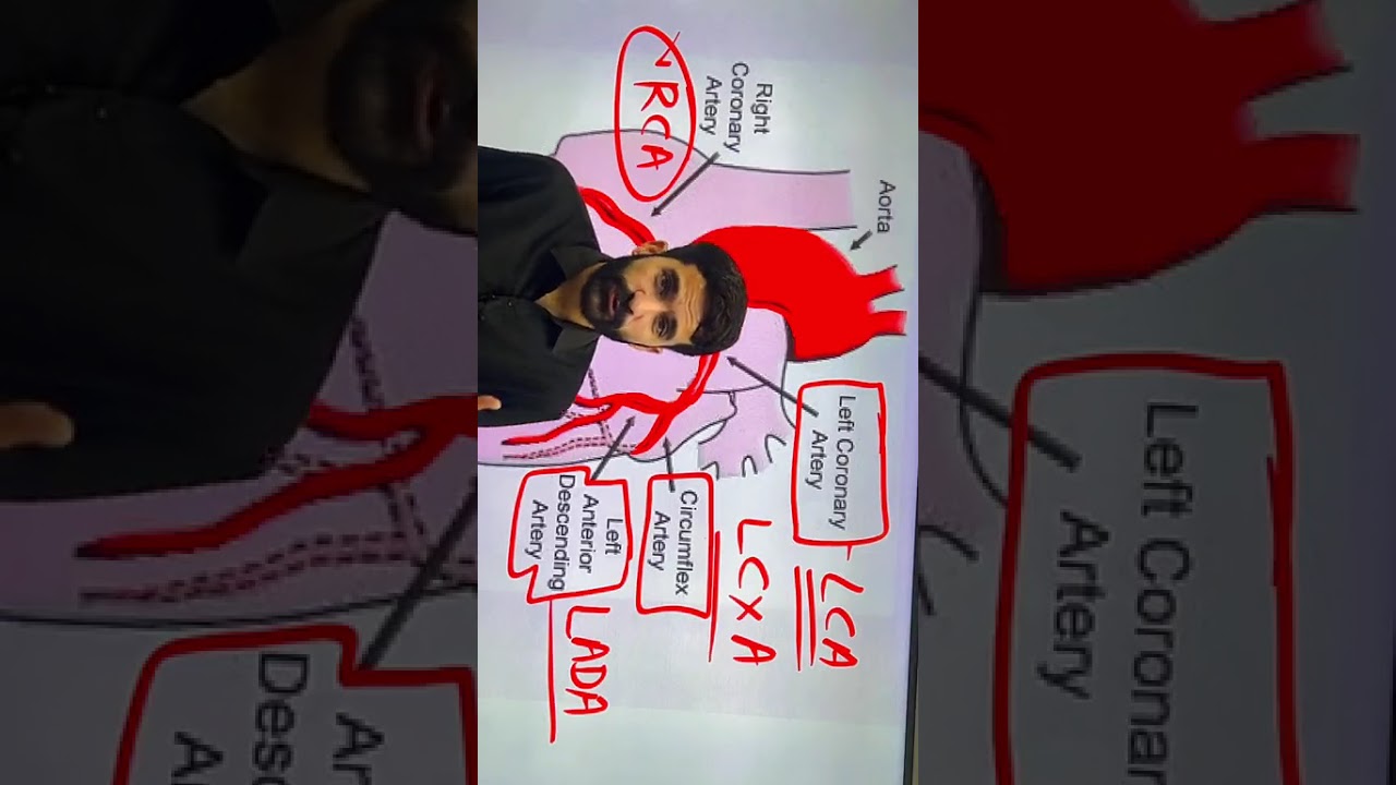 Myocardial Infarction (MI) || Heart Attack || #rajusir #rajusirnursingwala