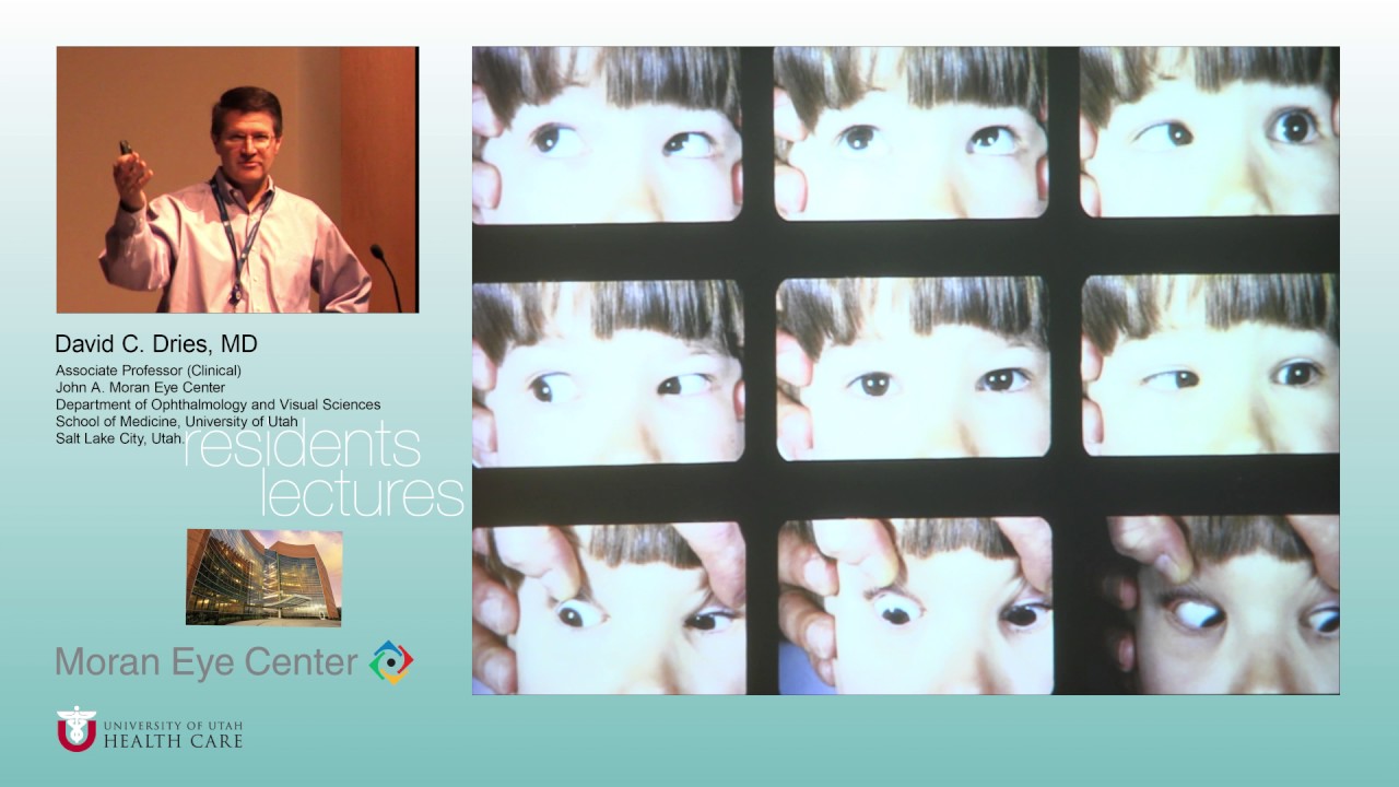 Vertical & Special Forms of Strabismus