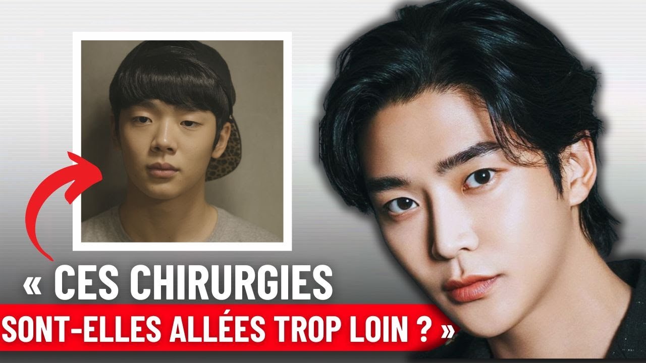Les chirurgies esthétiques les plus extrêmes de l’histoire des K-dramas