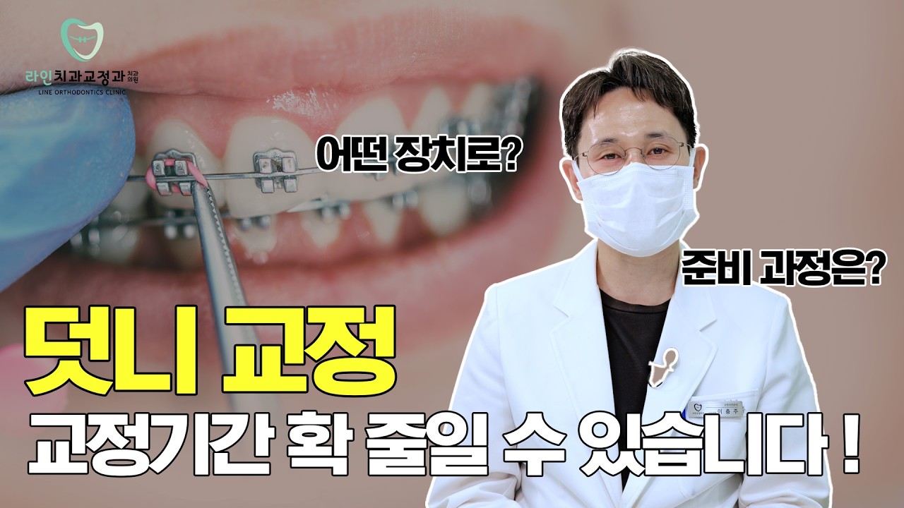 덧니 교정, 언제 시작해야 할까요? 😮 기간·장치·치료 과정까지 총정리 | 덧니 Q&A (심화편)