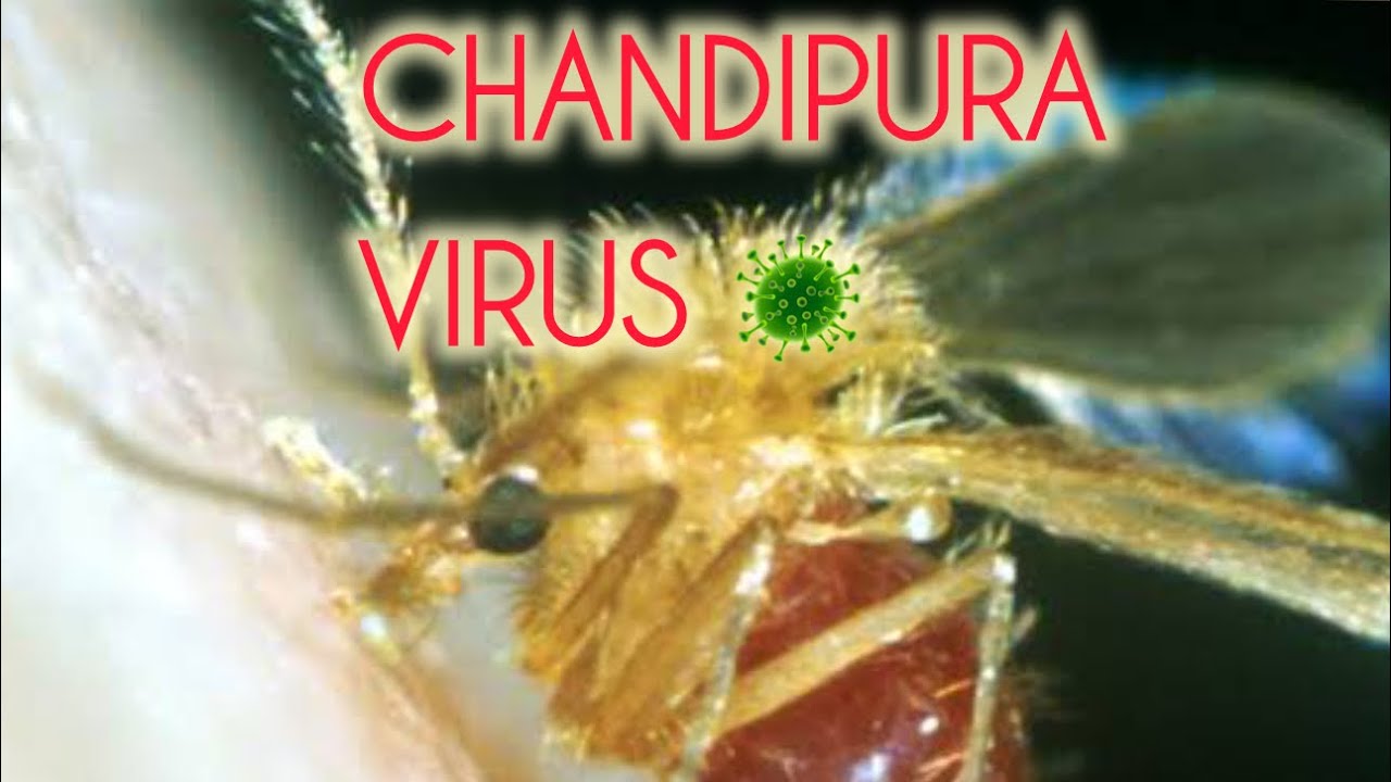 Chandipura virus 🦠 #drimranpatel #chandipuravirus #awareness