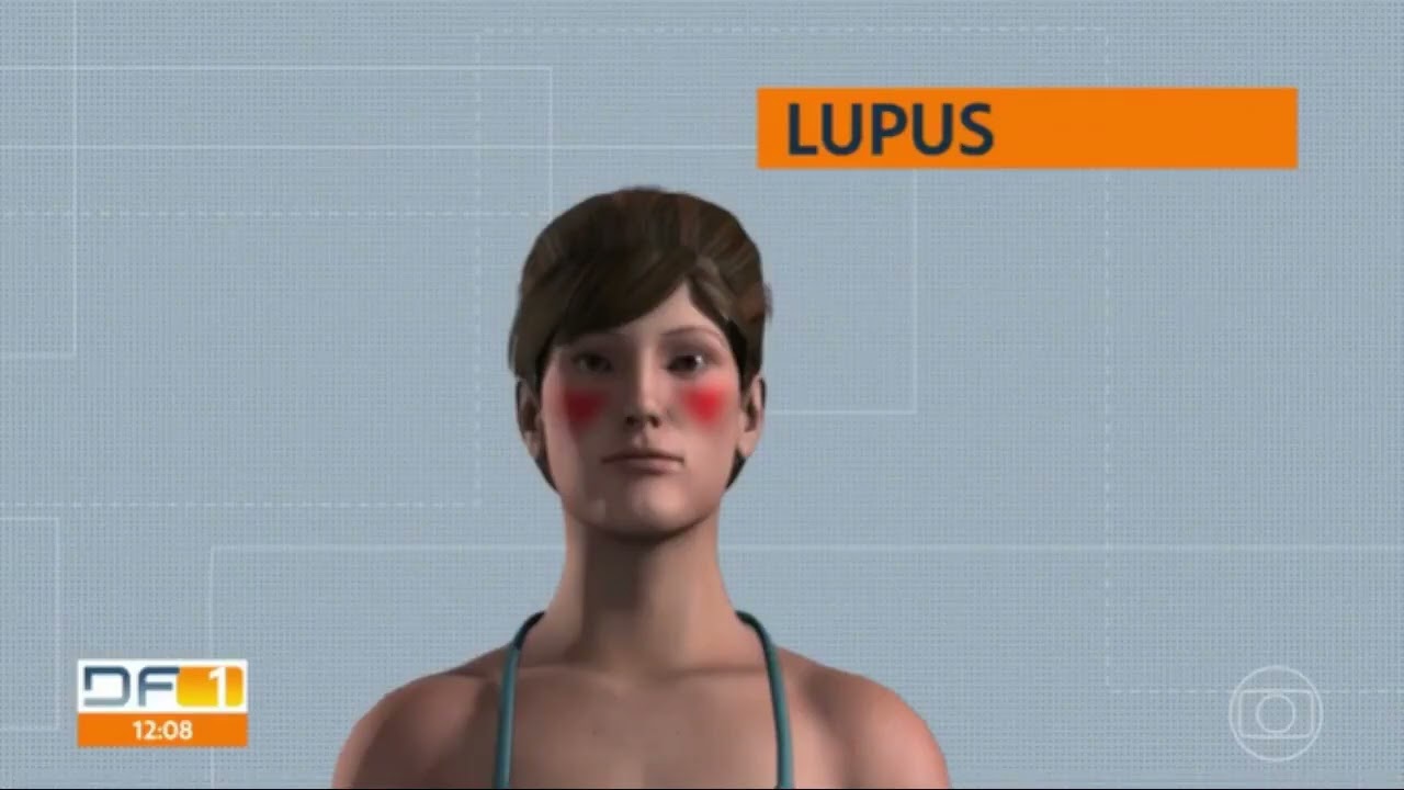 TV Globo Brasília  |  DF1 | Dia mundial da conscientização do Lúpus