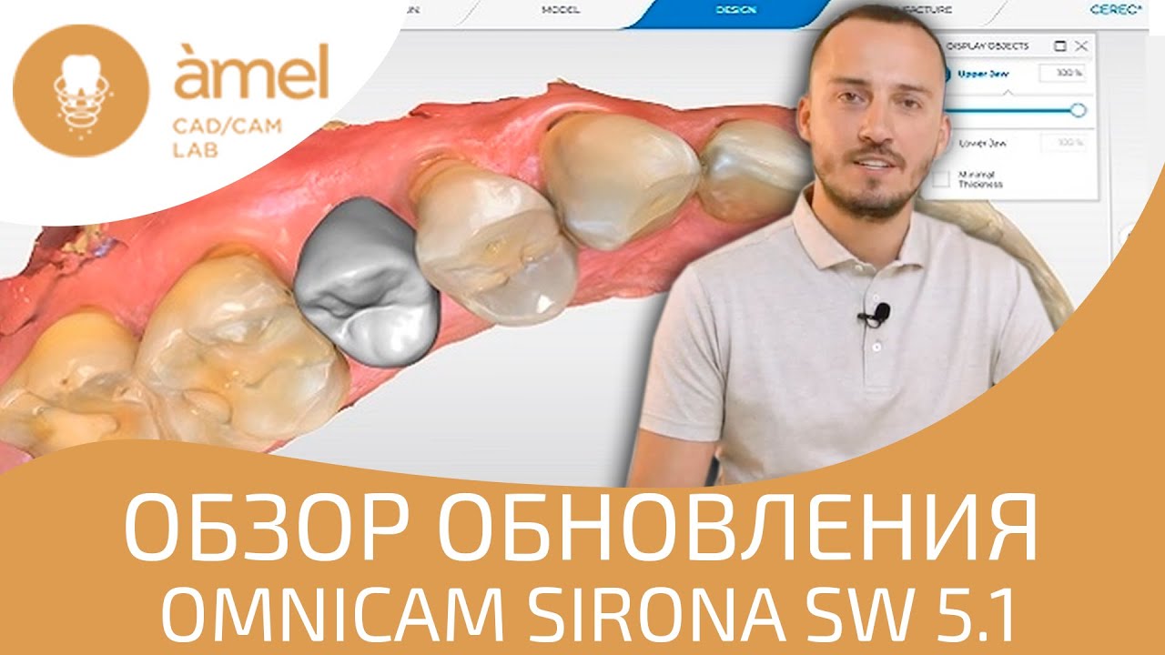 Обновление Omnicam Sirona - SW 5.1 - обзор нововведений