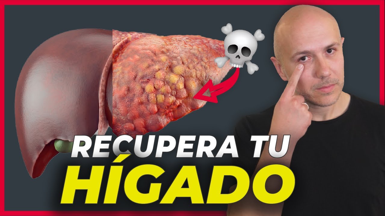 Así Se Cura El Hígado Graso (Sin Medicamentos) | Dr. Carlos Jaramillo