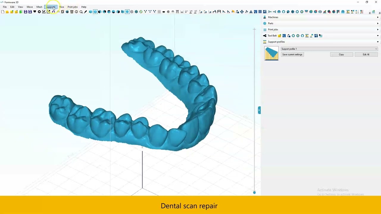 Dental model repair