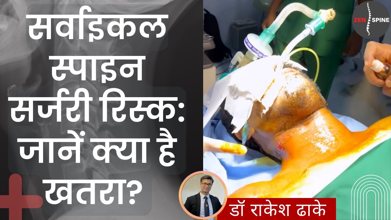 सर्वाइकल स्पाइन सर्जरी की रिस्क (Cervical Spine Surgery Risks): जानें क्या है खतरा? Hindi