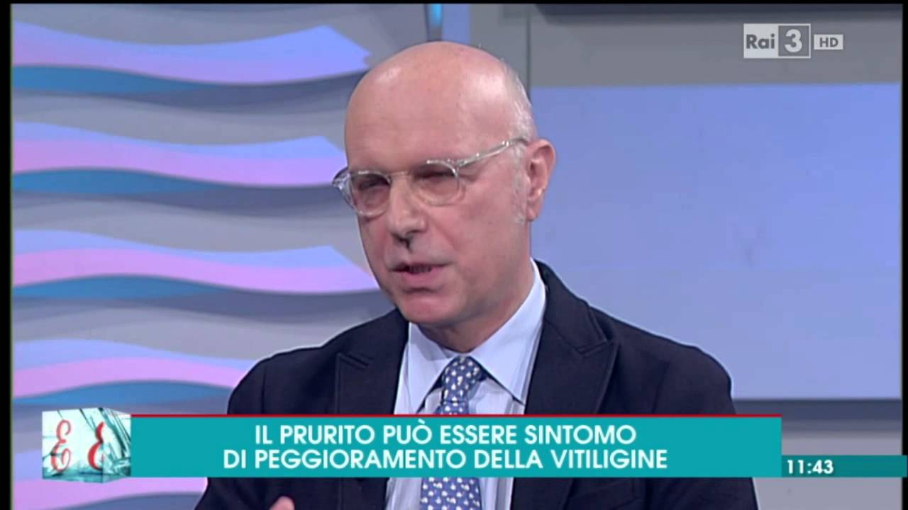 Tutto sulla vitiligine