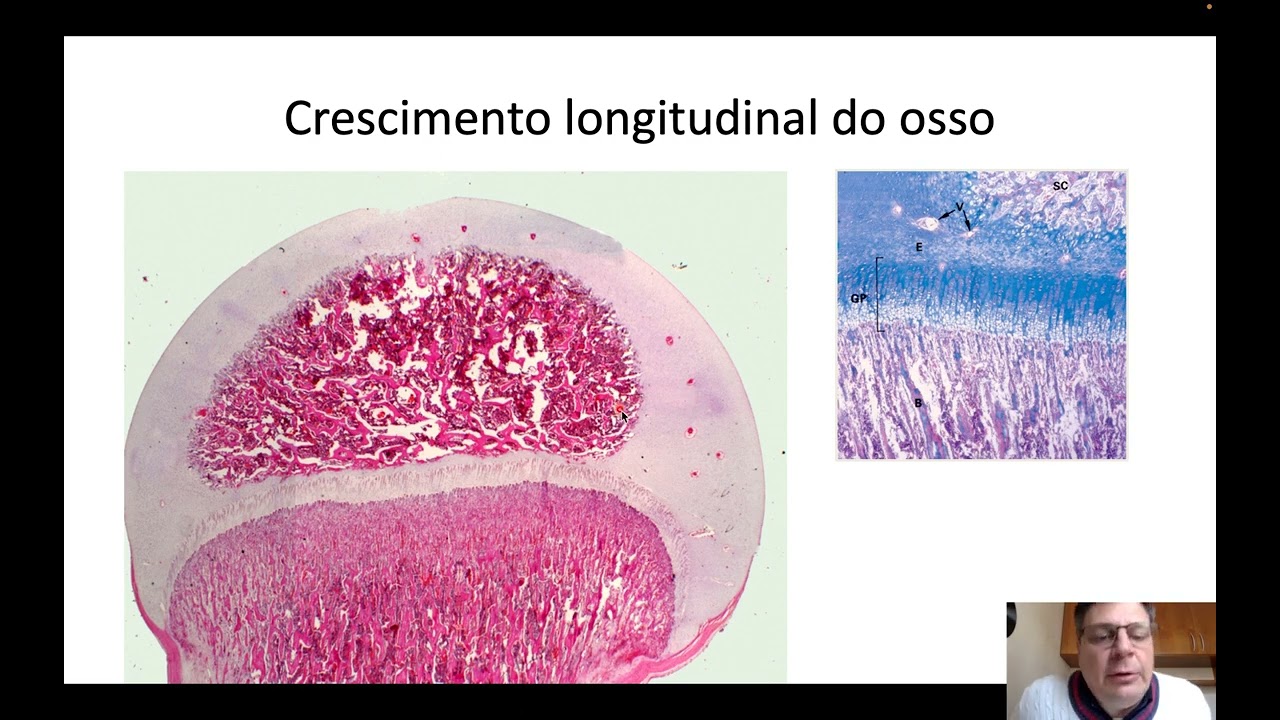 Histologia do tecido ósseo 03 - Ossificação intramembranosa e endocrondal, crescimento e remodelação