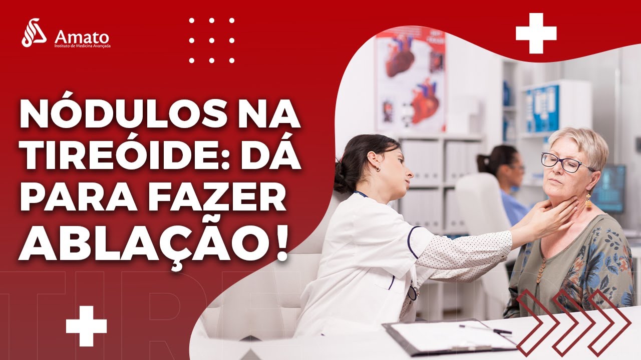 Preservando a Tireoide: Ablação de Nódulo Tireoidianos