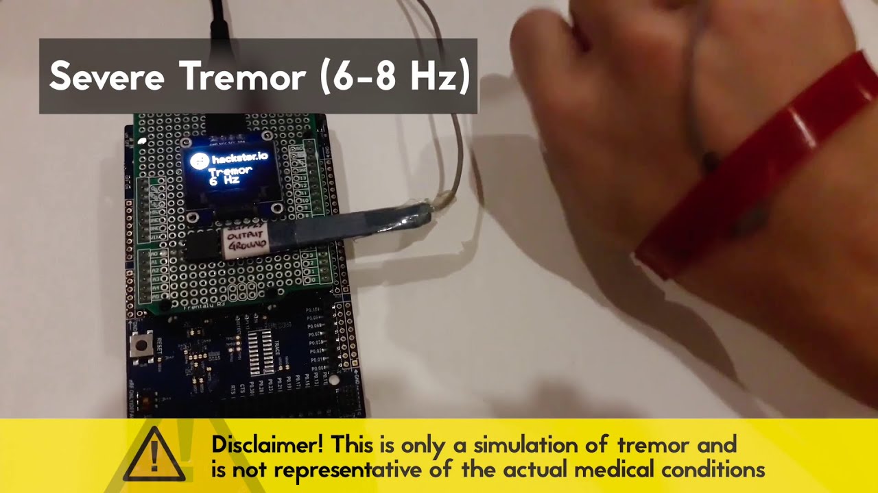 Tremor Health Analytics - Demo Video