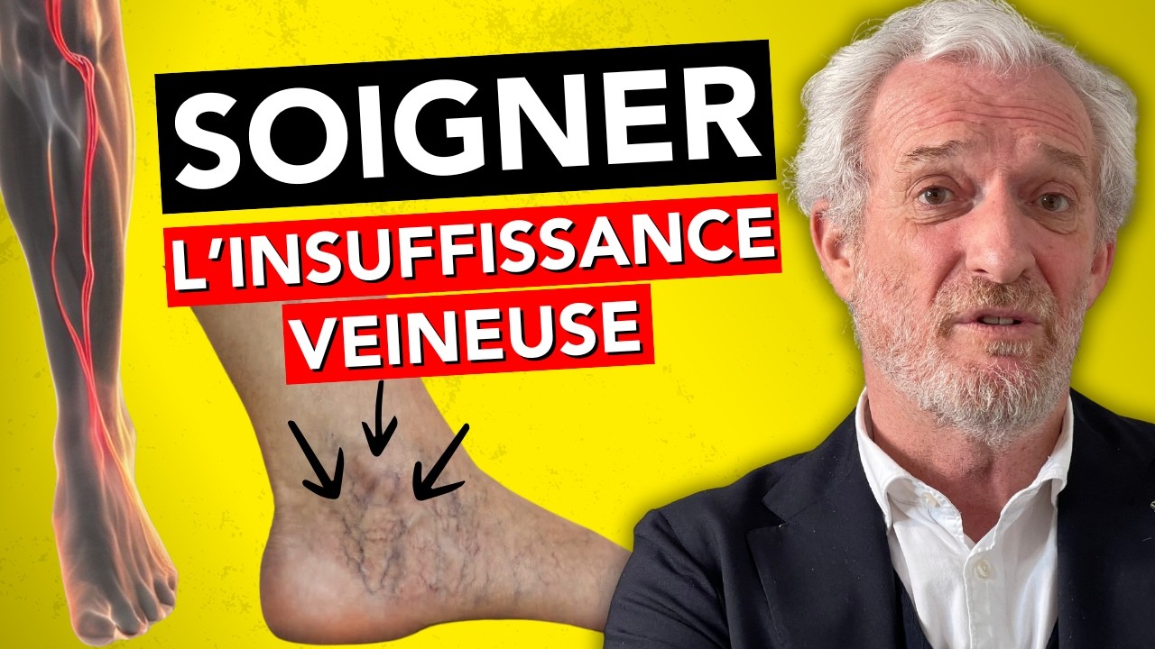 L'EXPERT des VEINES alerte sur L'INSUFFISANCE VEINEUSE [Dr Néaume]
