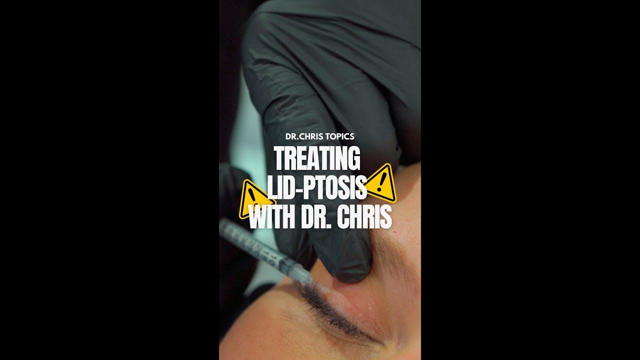 How To Treat a Eyelid-Ptosis After Botox Treatment | Botox Complications