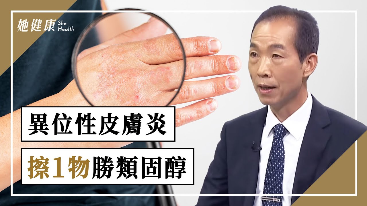 異位性皮膚炎 手肘窩、膝蓋後抓不停？4穴有效止癢！擦1物勝類固醇！掌握「7要訣」根治防復發！｜林源泉 醫師｜623