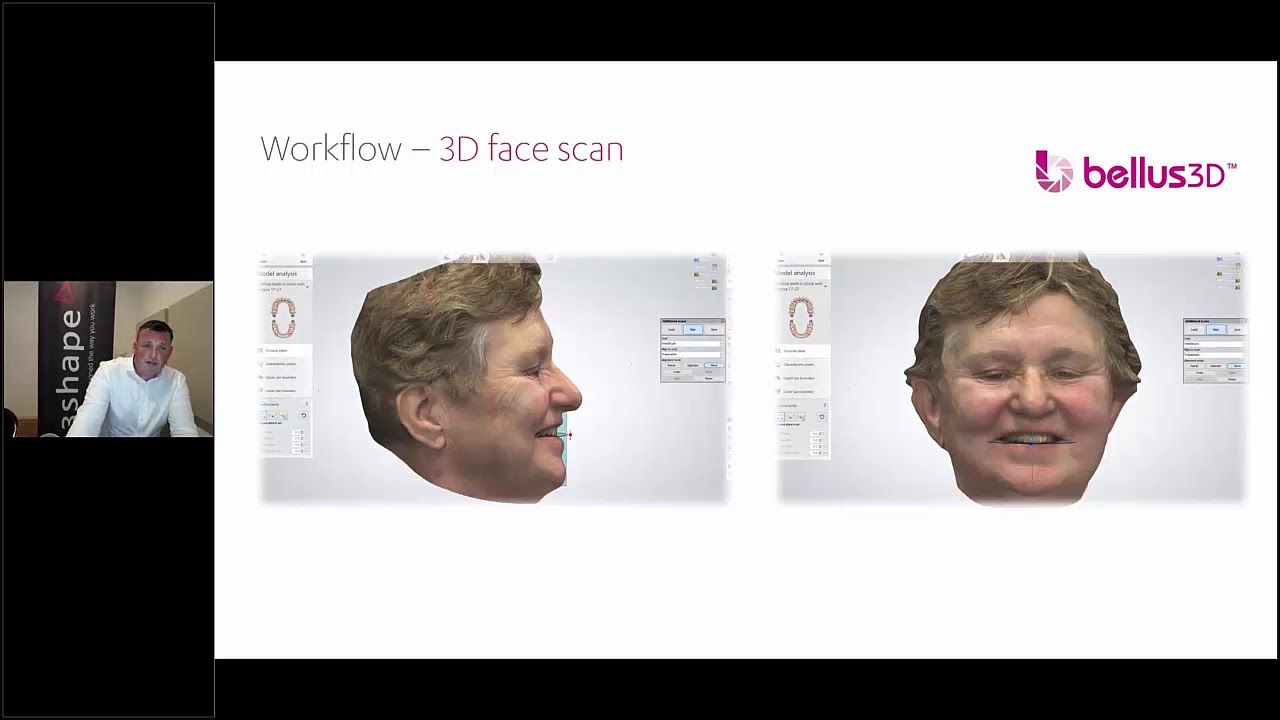 “Digital dentures - all you need to know” - 3Shape webinar with Rune Frisker and Germen Versteeg