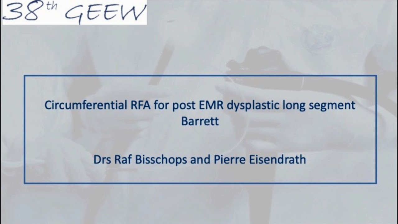 EGD and RFA for Barrett's esophagus- 38thGEEW 2021- Experts: Raf BISSCHOPS & Pierre EISENDRATH