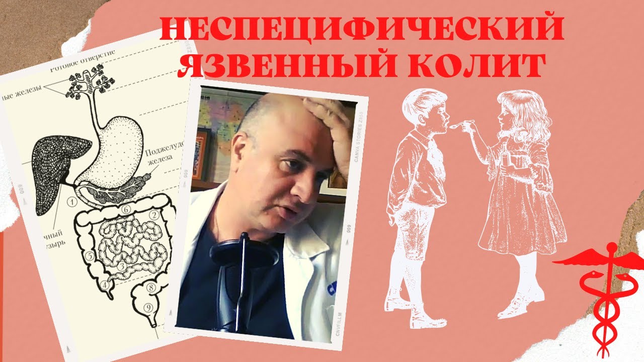 Язвенный (неспецифический) колит | НЯК - это проблема не только кишечника!