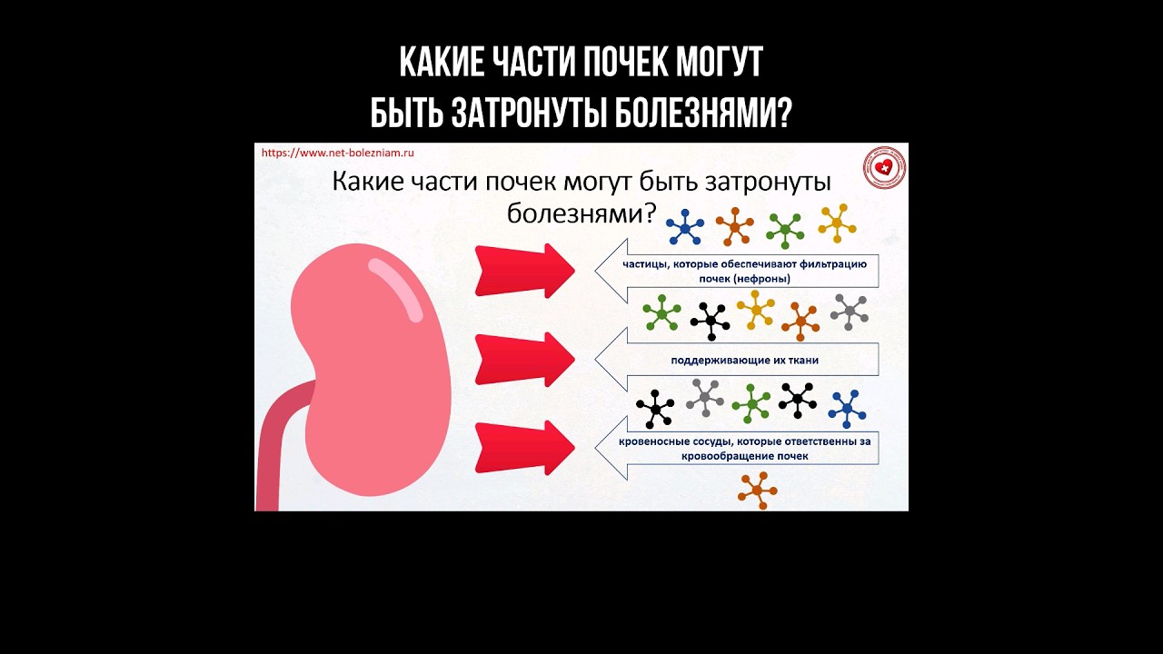 Какие части почек могут быть затронуты болезнями? #почки #нефрон #почка #нефрология