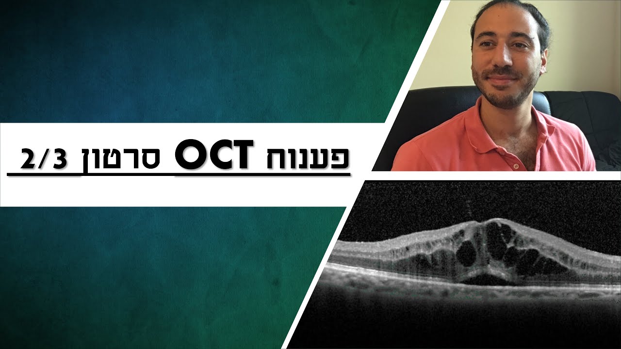 פענוח OCT, סרטון 2/3