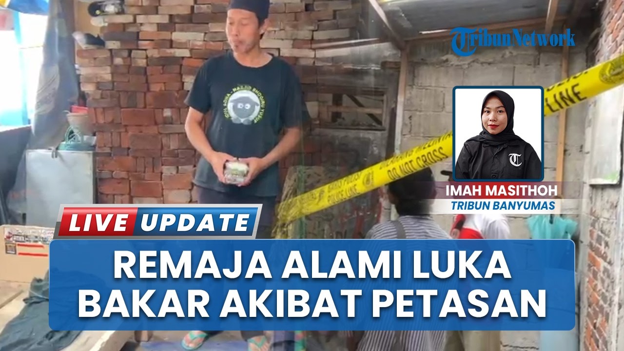 Remaja 13 Tahun di Kertek Wonosobo Alami Luka Bakar seusai Petasan yang Dibuatnya Meledak
