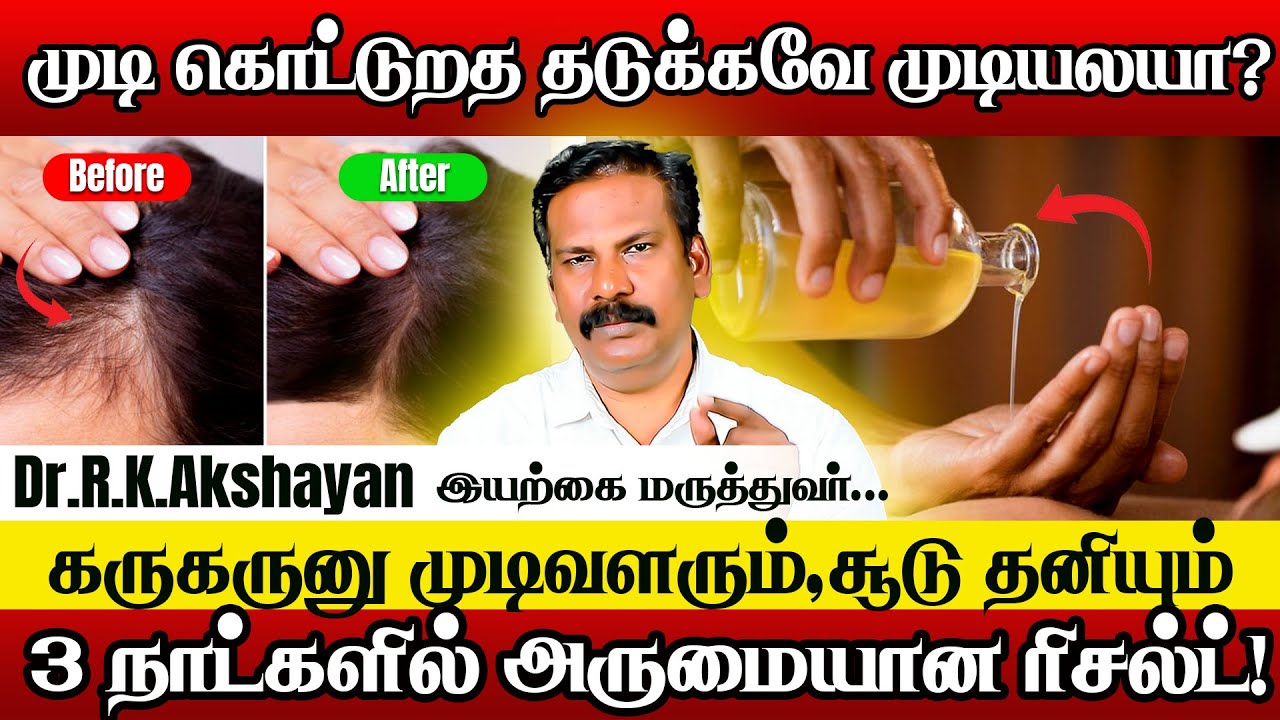கொத்து கொத்தா முடி கொட்டுதா கவலையே வேண்டாம் | Dr.RK.Akshayan | Haie Care