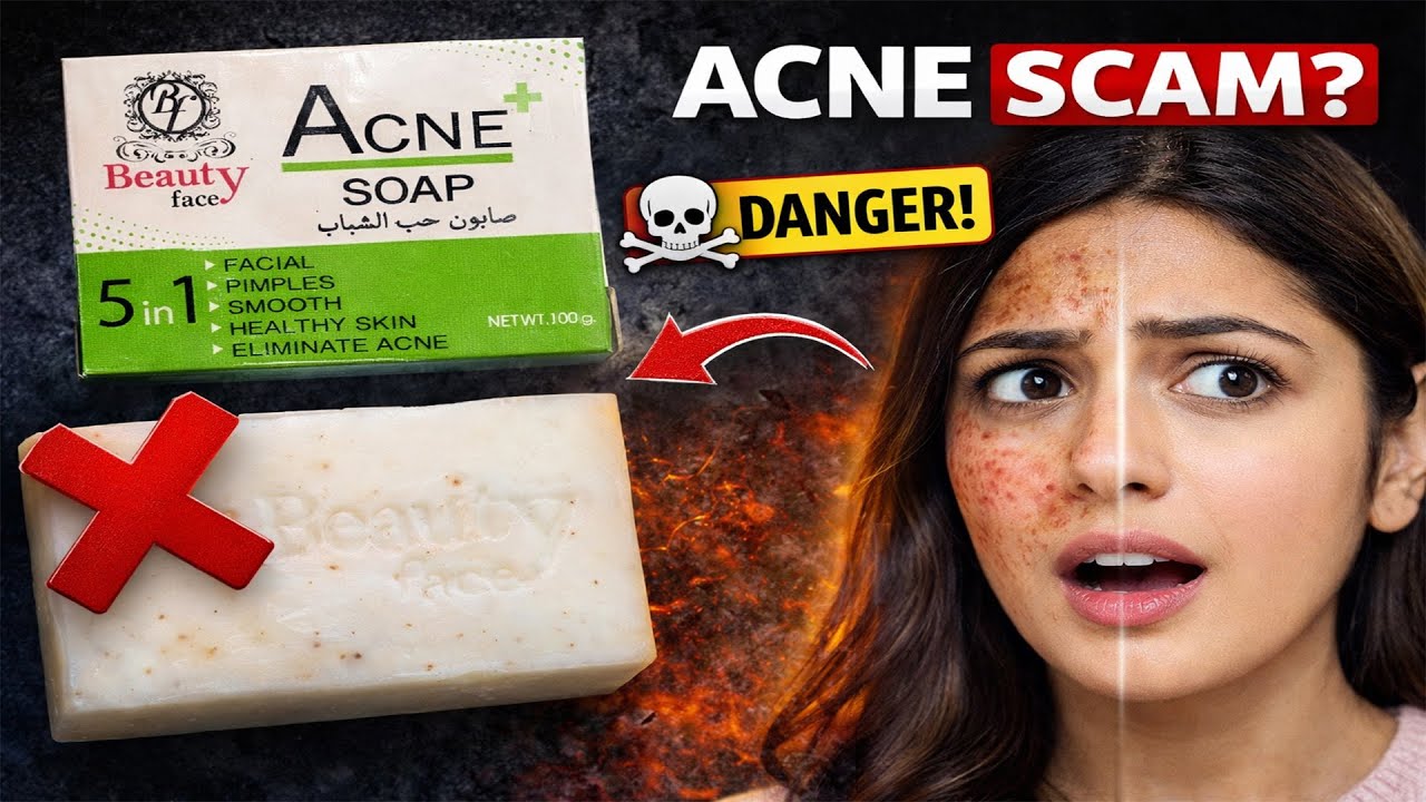 Beauty Face Acne Plus Soap Review 😱 | Acne Khattam Ya Skin Damage? Truth in Urdu