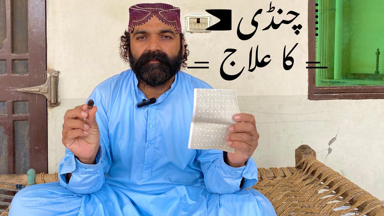 Aseel Murgy ki Chandi ka ilaj  | BumbleFoot  in chickens