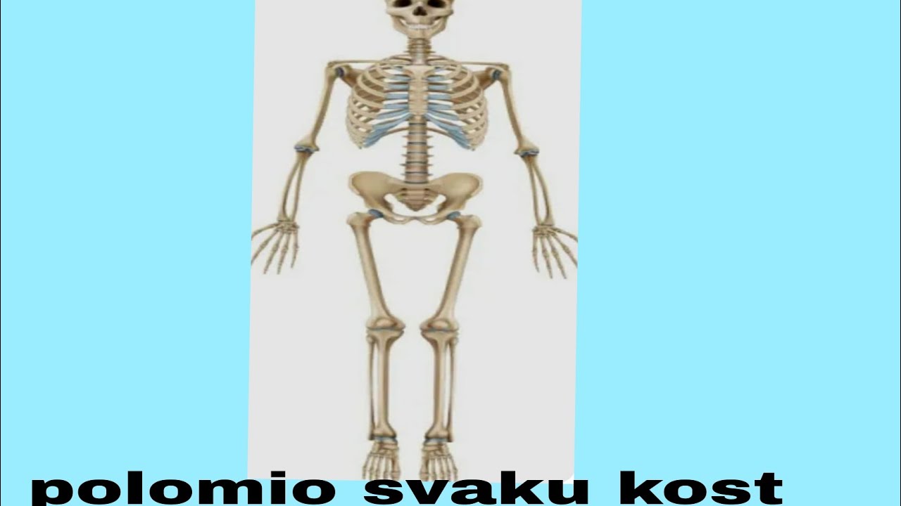 Polomio sam sve kosti!!