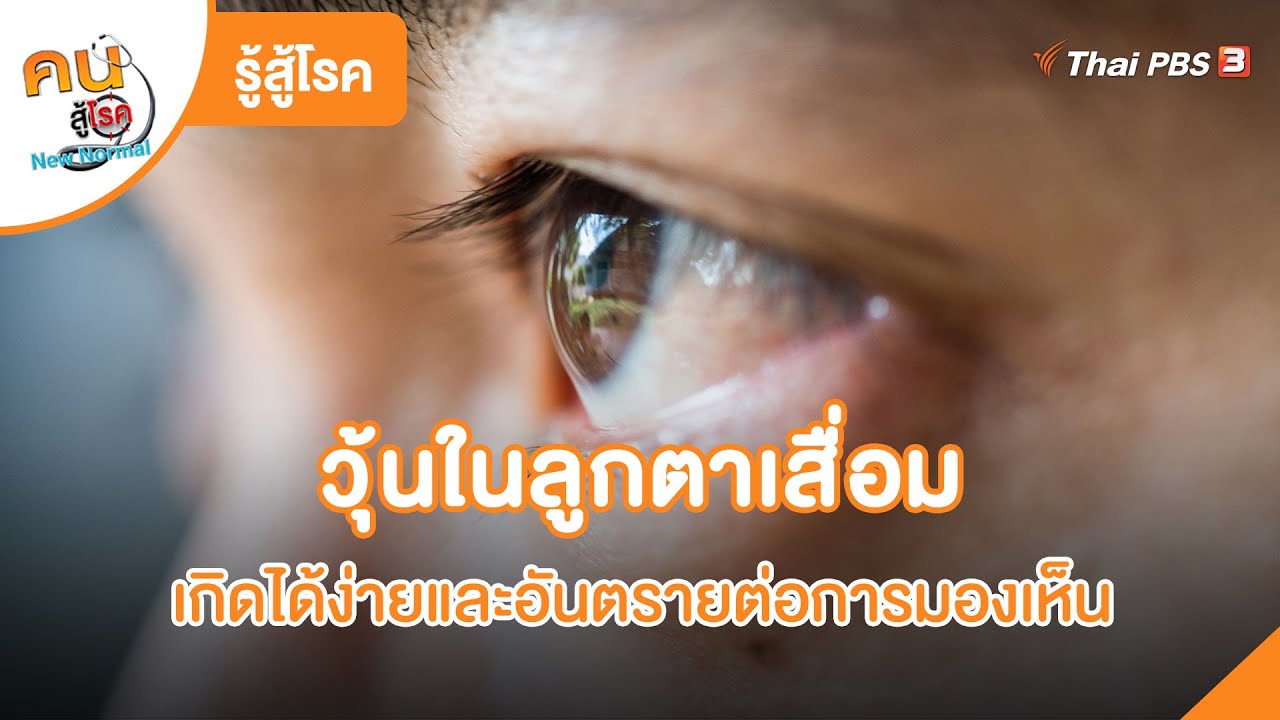 วุ้นในลูกตาเสื่อม เกิดได้ง่ายและอันตรายต่อการมองเห็น | รู้สู้โรค