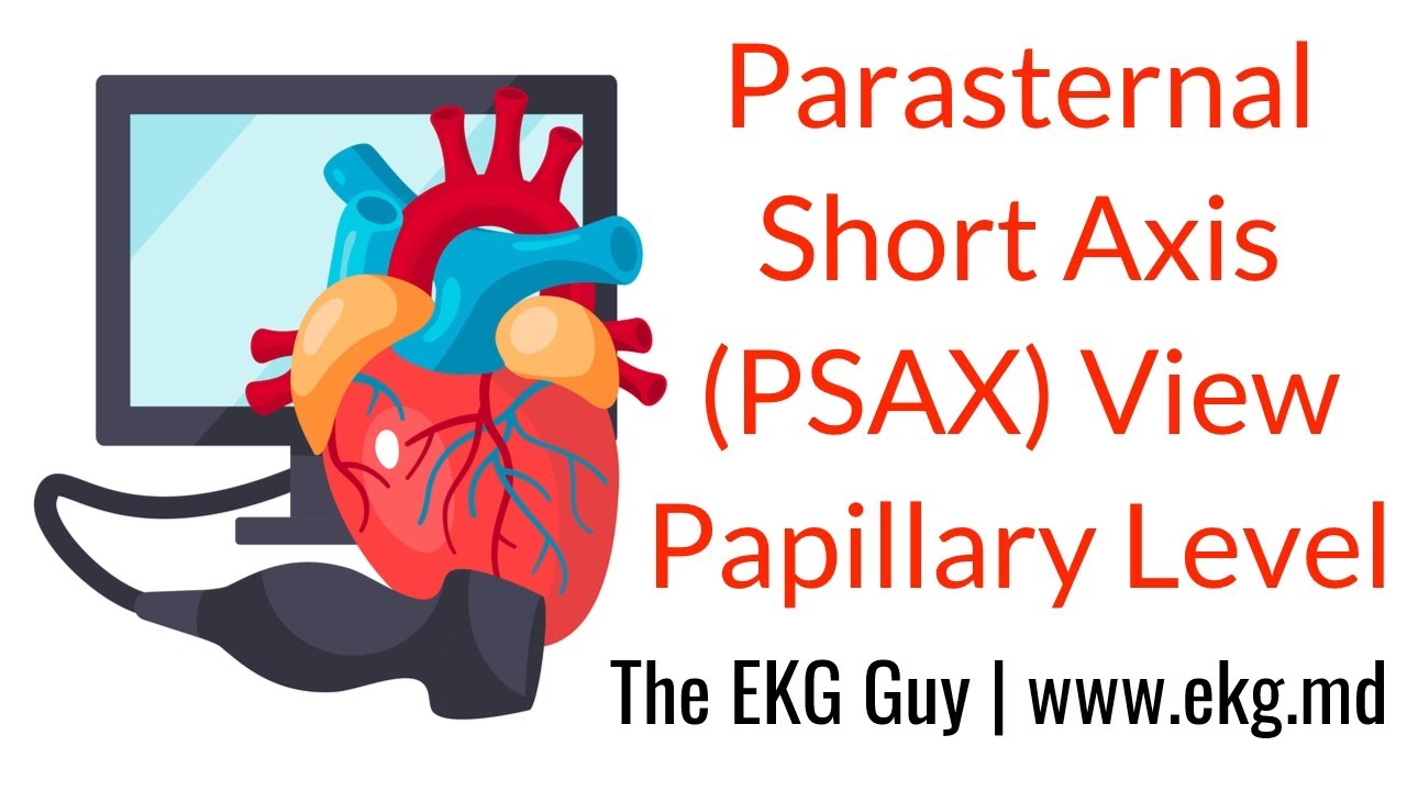 Parasternal Short Axis View (Papillary Level) - ECHO Course l The EKG Guy - www.ekg.md