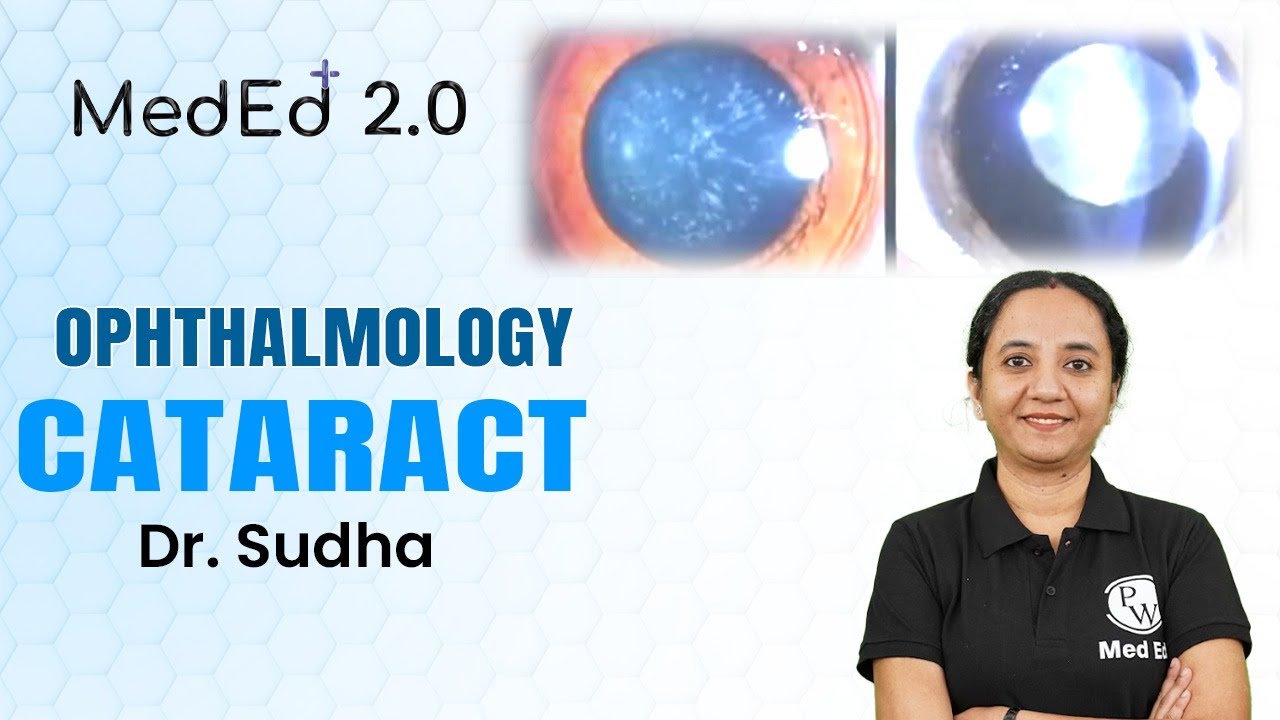 Cataract | Ophthalmology | Dr. Sudha | MedEd 2.0
