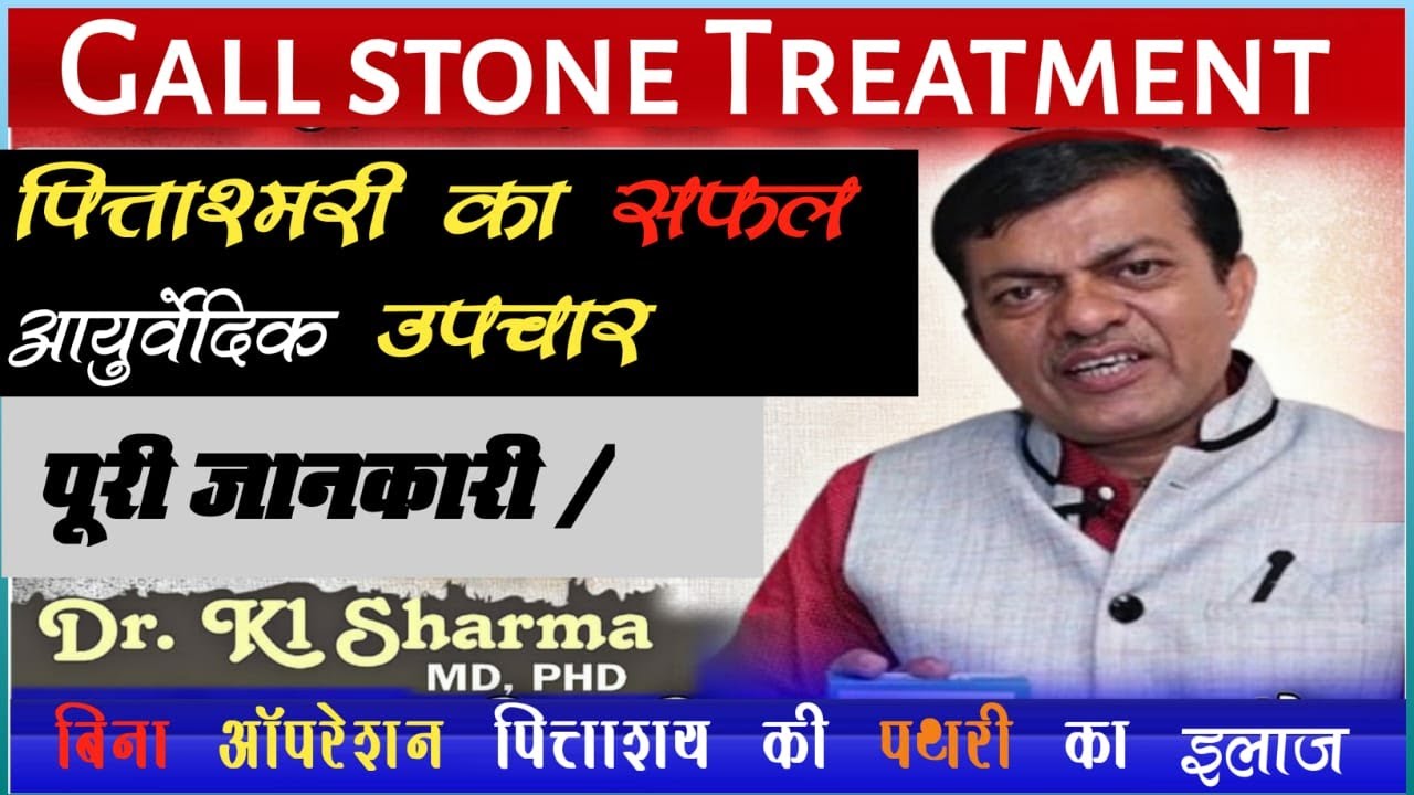 Gall stone treatment by Dr KL SHARMA #gallstone #liver