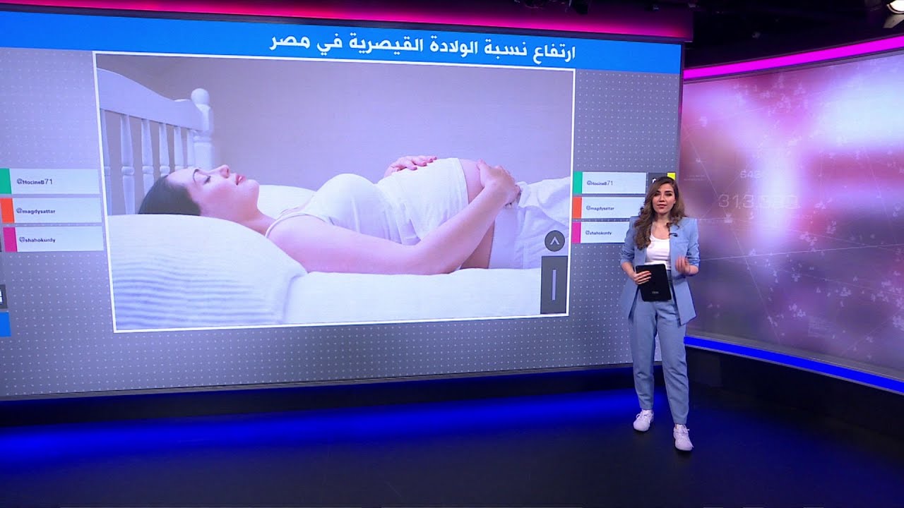 أرقام صادمة للولادة القيصرية في مصر ووزارة الصحة تحذر من مخاطرها