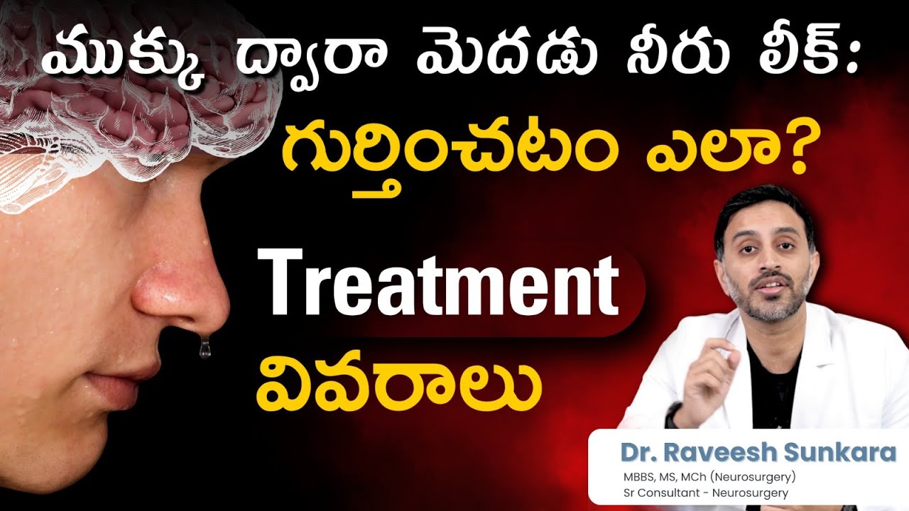 Brain Fluid Leak (CSF Rhinorrhea) in Telugu | Causes, Symptoms, and Treatment | Dr. Raveesh Sunkara