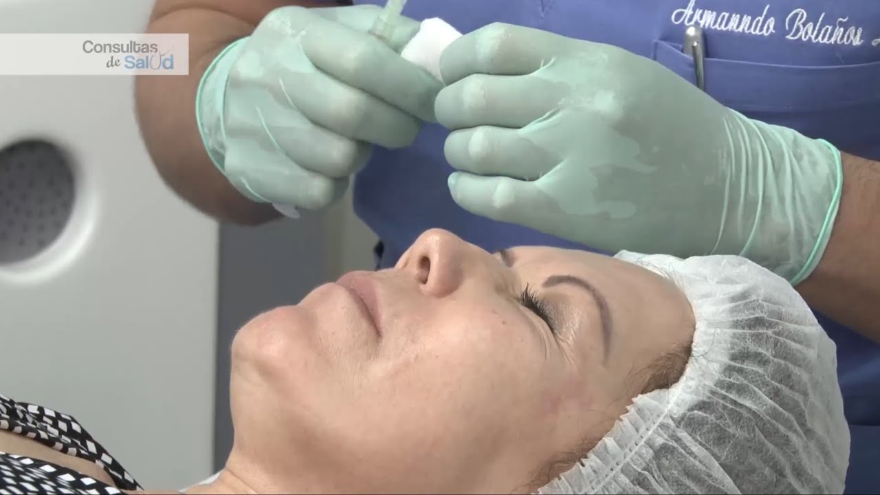 Plasma rico en plaquetas | Rejuvenecimiento facial Costa Rica