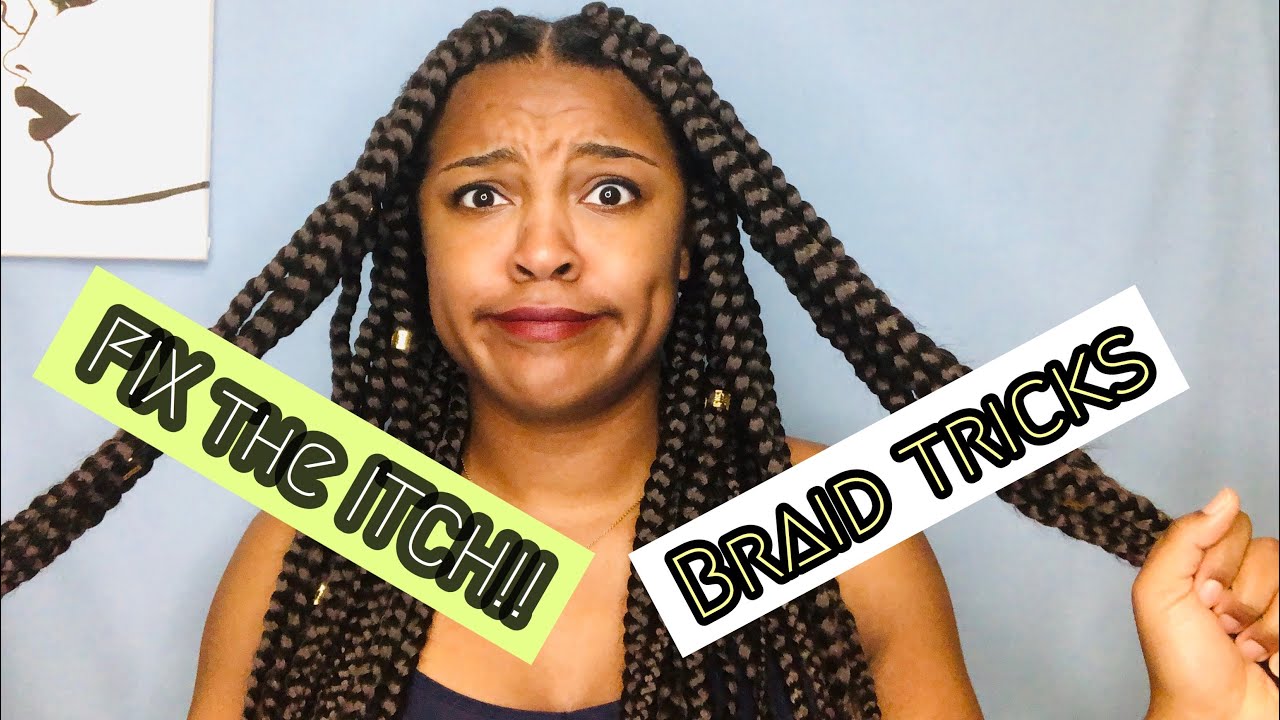 FIX THE BOX BRAID ITCH! || How to RELIEVE ITCHY SCALP from protective styles!