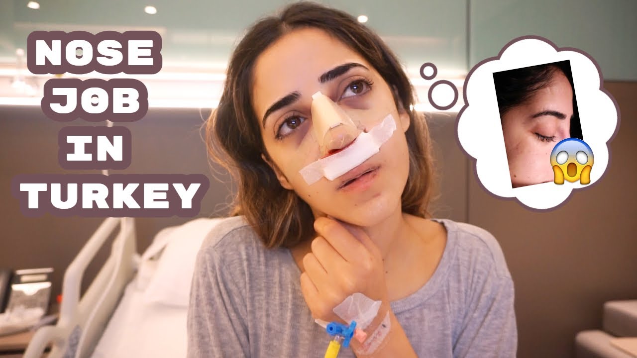 فلوغ عمليّة تجميل انفي - تركيا