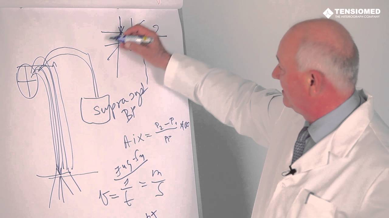 Arteriograph Market Segments - Working Principle Of Arteriograph - TensioMed Education
