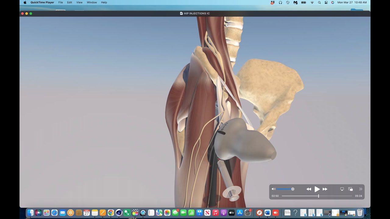 Ultrasound Guided Hip Joint Injection