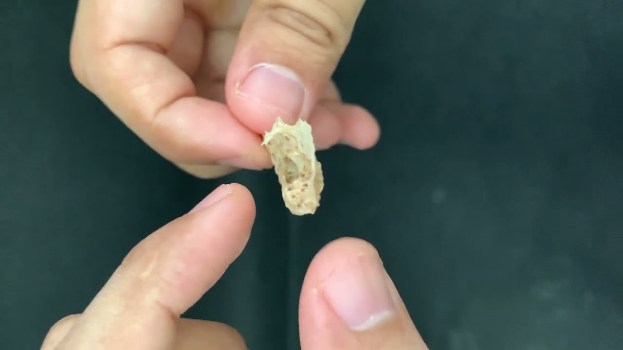 Anatomia do osso concha nasal inferior