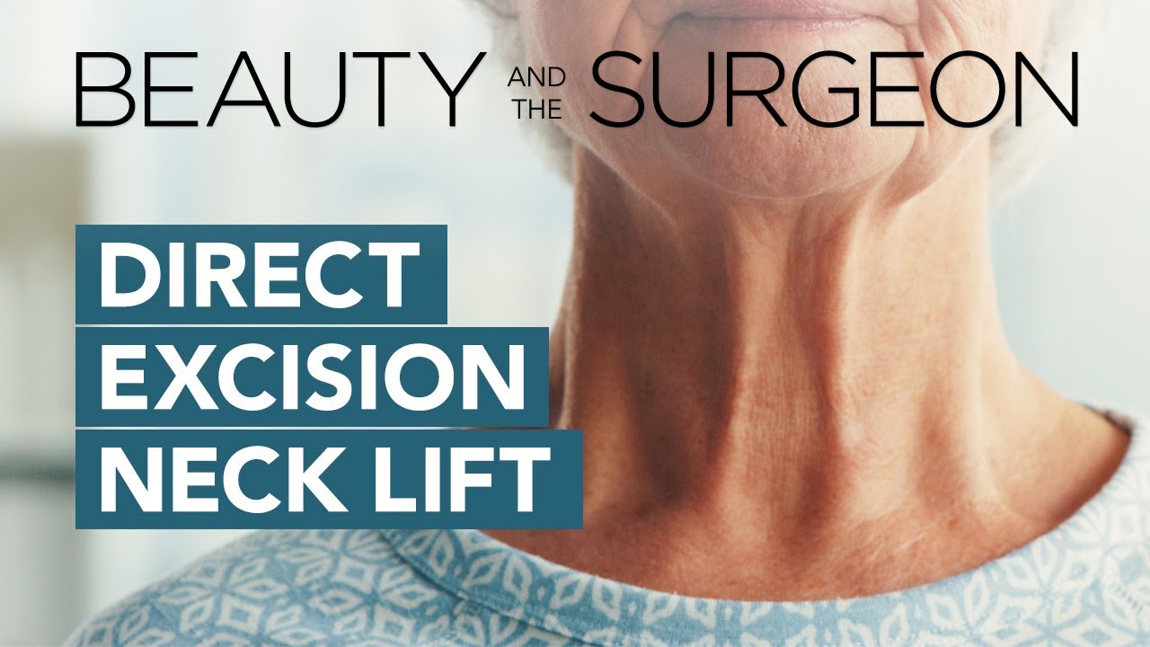 Direct Excision Neck Lift - Beauty and the Surgeon Episode 94