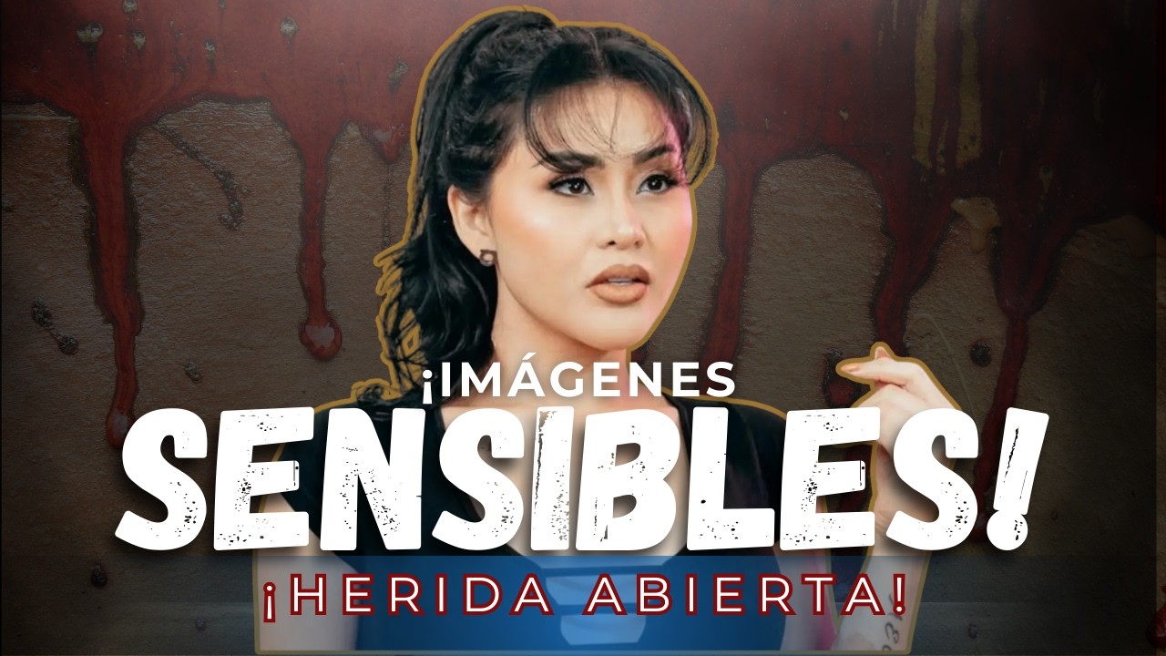¡GOMITA MUESTRA FOTOS MUY FUERTES DE SU HERIDA!