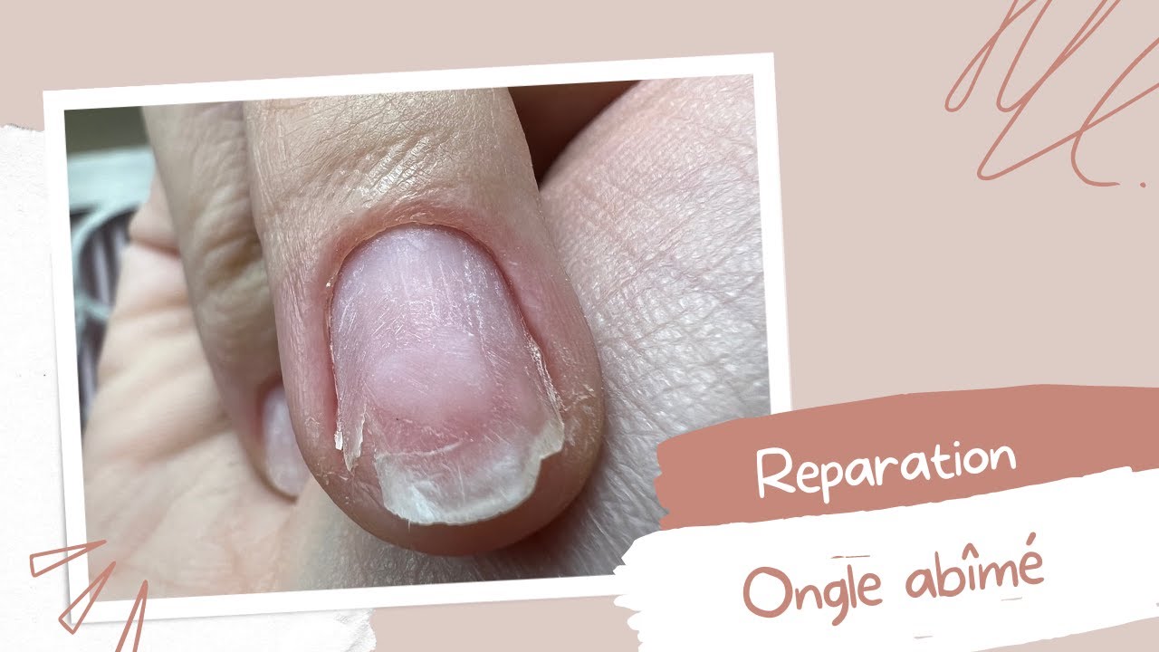 TUTO ONGLE : Réparation d'ongle abimé