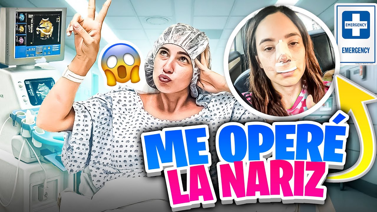 Me OPERE la NARIZ y me QUEDO PEOR? 😨 | La OPERACION CASI sale MAL 😱 | Los Molina
