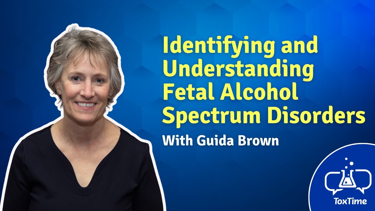 ToxTime: Identifying and Understanding Fetal Alcohol Spectrum Disorders (FASDs)